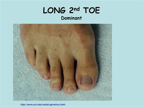 Understanding Toe Holds: A Foundation for Dominance