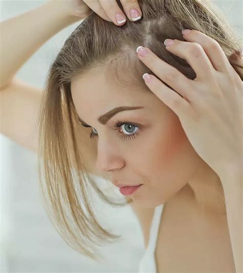 Understanding Women's Hair Loss at Temples