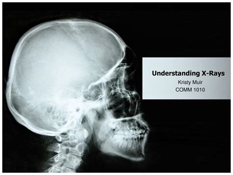 Understanding X-Rays