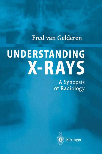 Understanding X-Rays A Synopsis of Radiology Kindle Editon