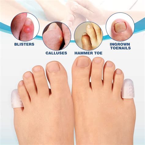 Understanding and Managing Blisters on Pinky Toes: An In-Depth Guide