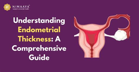 Understanding and Mitigating Miss Thickness: A Comprehensive Guide