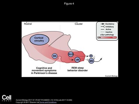 Understanding the Causes and Symptoms of RBD