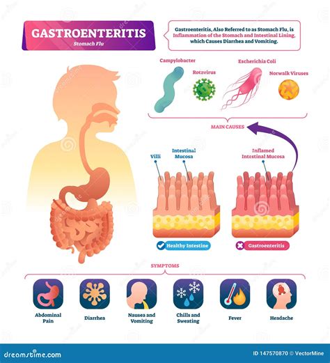 Understanding the Causes of Intestinal Infections