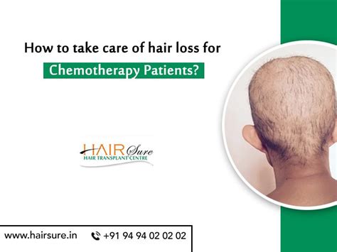 Understanding the Impact of Hair Loss on Chemo Patients