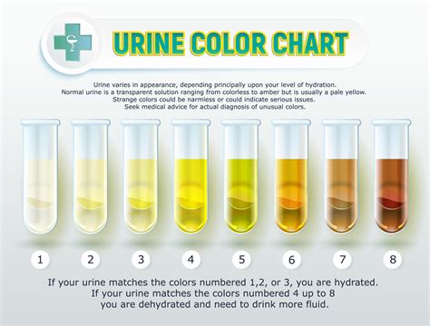 Understanding the Importance of Urine Analysis