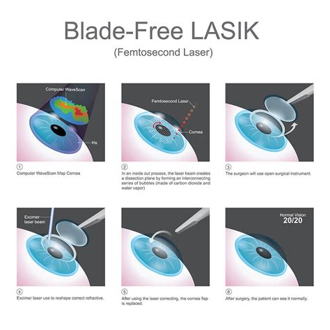 Understanding the Laser Eye Generator