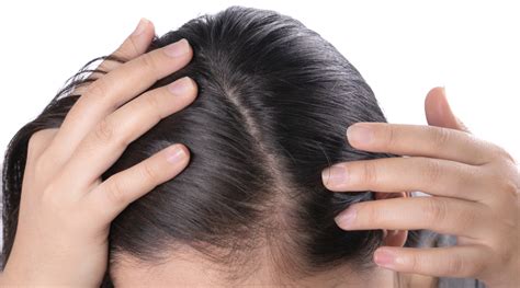 Understanding the Scalp's Structure