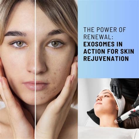 Unlocking the Power of Skin Renewal