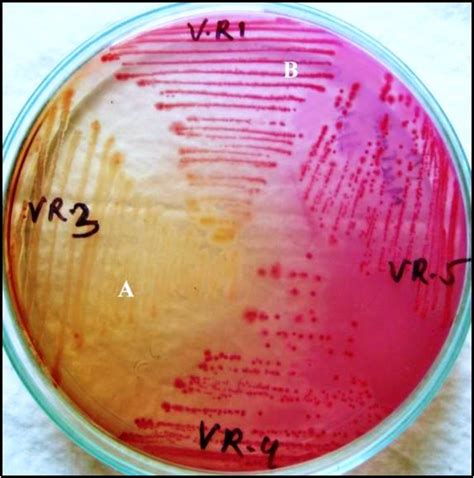 Unlocking the Secrets of Salmonella: Unveiling the Power of Wilson and Blair Medium