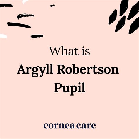 Unmasking the Secrets of the Argyll Robertson Pupil: A Comprehensive Guide