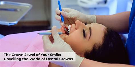 Unveiling the Crown Jewel of Dentistry: Crown 89