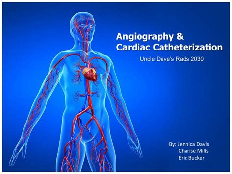 Unveiling the Heart: A Deep Dive with Cardiac Catheterization PPT