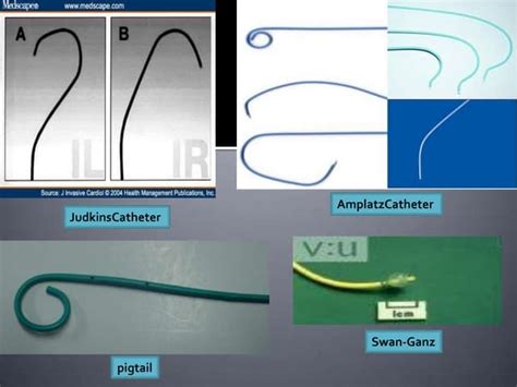 Unveiling the Heart: A Deep Dive with Cardiac Catheterization PPTs