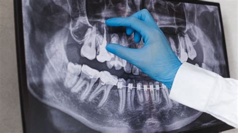 Unveiling the Hidden Truths of Oregon's Dental Coverage