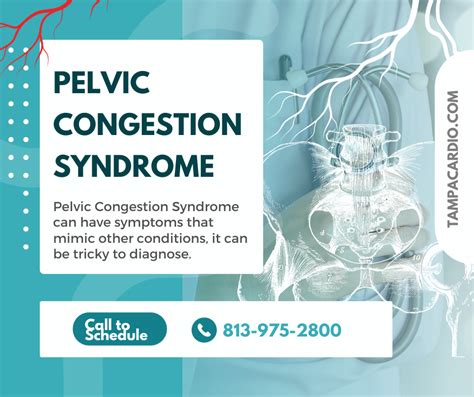 Unveiling the Tittymonster: A Comprehensive Guide to Understanding and Overcoming Chest Congestion