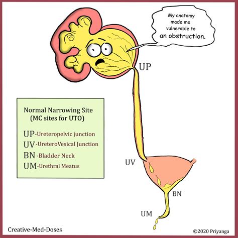 Urethral obstruction: