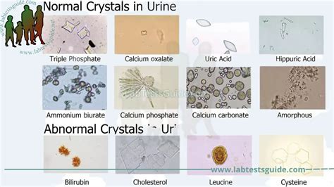 Urinary Crystals in Cats: A Comprehensive Guide to Detection, Prevention, and Treatment