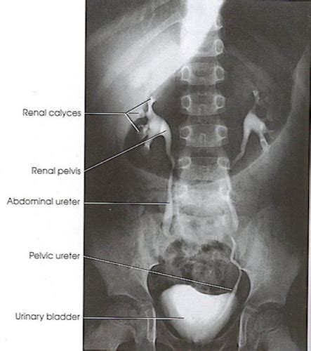 Urinary System Radiographic Anatomy Positioning and Procedures Reader