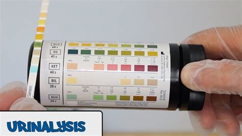 Urine dipstick test: