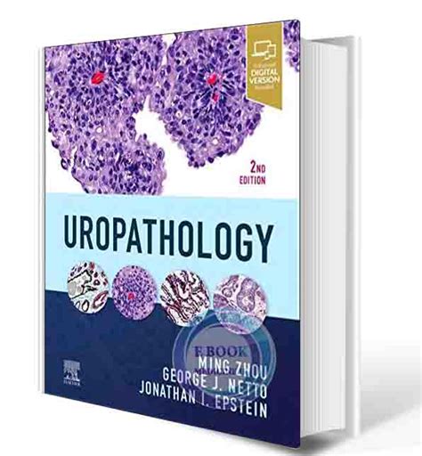 Uropathology 1st Edition Epub
