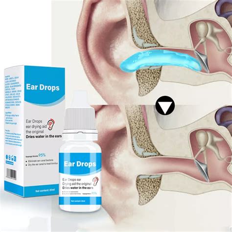 Use over-the-counter ear drops.