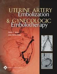Uterine Artery Embolization and Gynecologic Embolotherapy Kindle Editon