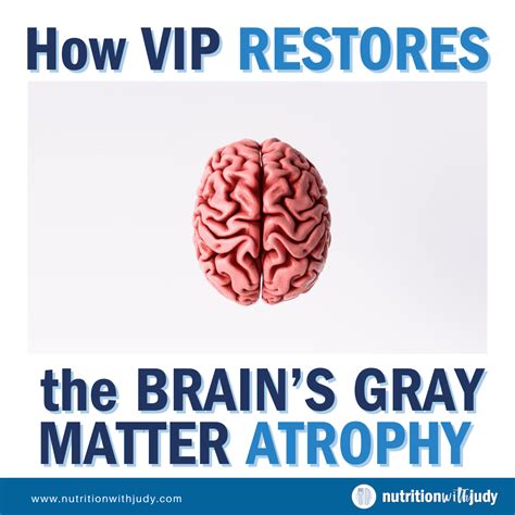 VIP Benefits That Matter