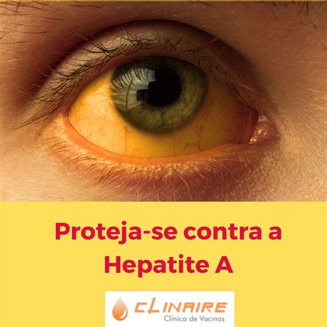 Vacina Hepatite A: Protegendo-se Contra Uma Infecção Hepática Grave