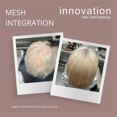 Vacuum Wigs: Embracing Innovation for Hair Restoration