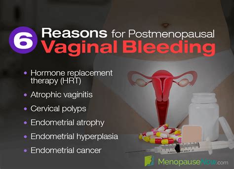 Vaginal bleeding or spotting after menopause: