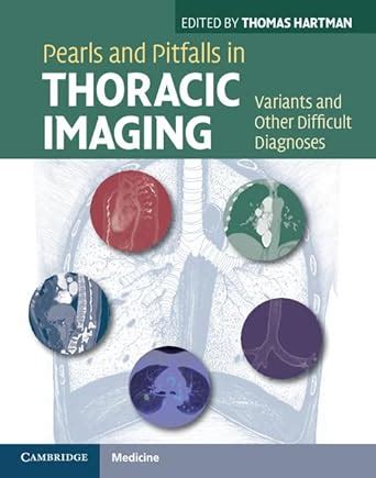 Variants and Pitfalls in Body Imaging Thoracic Kindle Editon