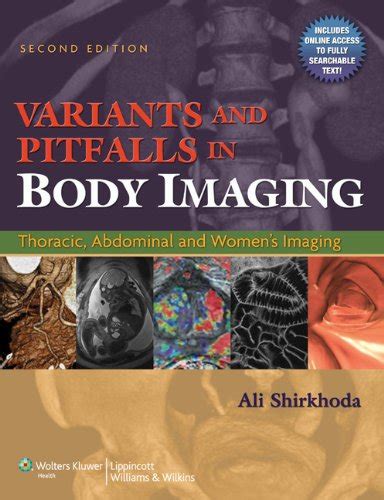 Variants and Pitfalls in Body Imaging Thoracic, Abdominal and Women's Imaging Kindle Editon