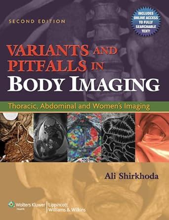 Variants and Pitfalls in Body Imaging Thoracic, Abdominal and Women's Imaging Kindle Editon