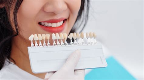 Veneers Singapore Price: The Ultimate Guide to Cost and Value