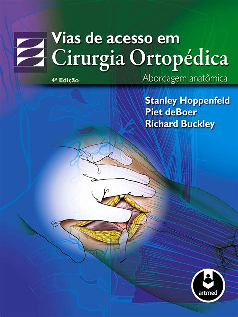 Vias de Acesso em Cirurgia Ortopédica Abordagem Anatômica Portuguese Edition PDF