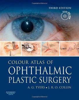 Video Atlas of Basic Ophthalmic Surgeries 1 DVD Edition Epub