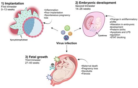 Viral Diseases in Pregnancy Kindle Editon