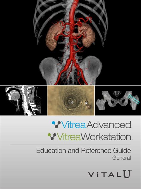 VitreaAdvancedEDUCATIONREFERENCEGUIDE-1- Ebook Reader