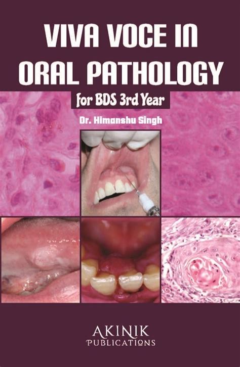 Viva in Oral Pathology Reader