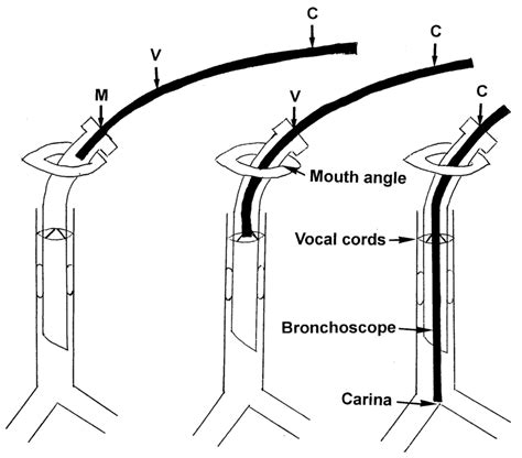 Vocal cord length: