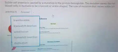 What Causes Sickle Cell Anemia Yahoo Answers Doc