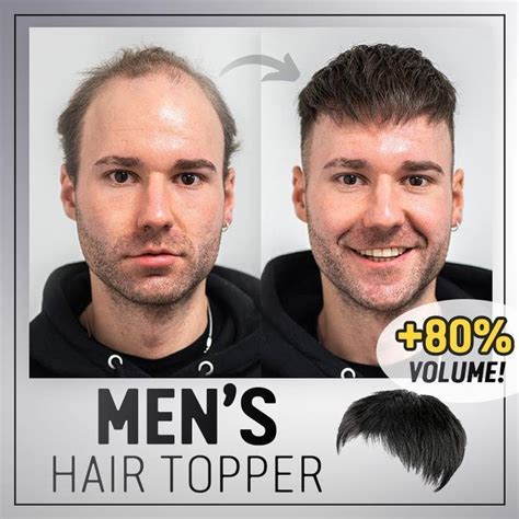 What are Hair Toppers for Men?