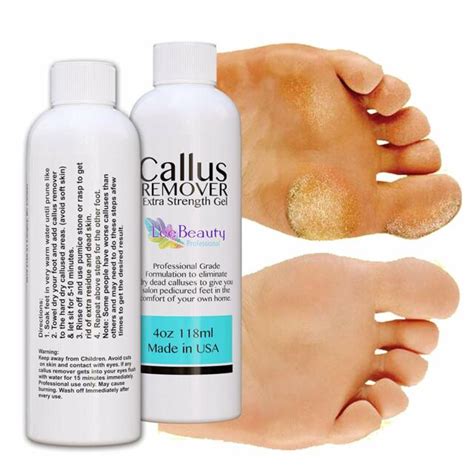 What is Callus Remover Oil?