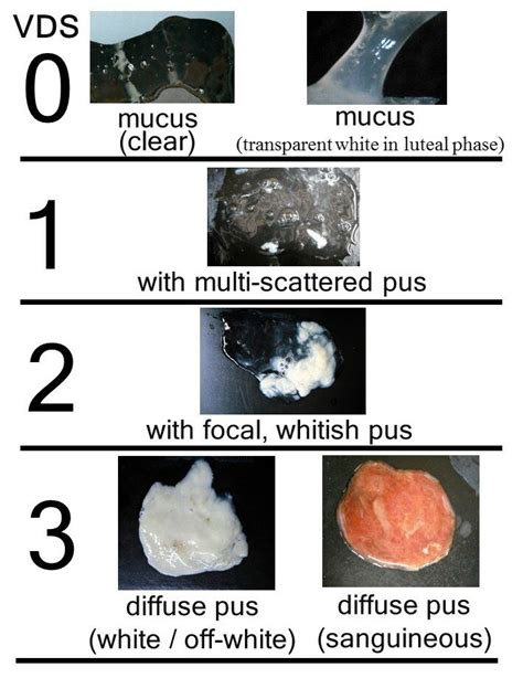 What is Clear Mucus?