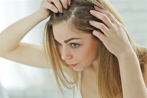 What is Hair Loss?