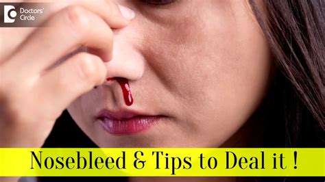 When to Worry About a Nosebleed