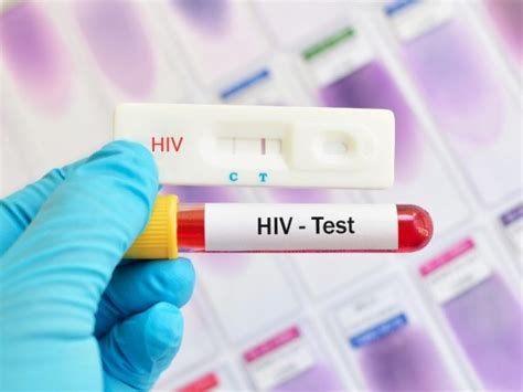 Where to Get an Anonymous HIV Test in Singapore