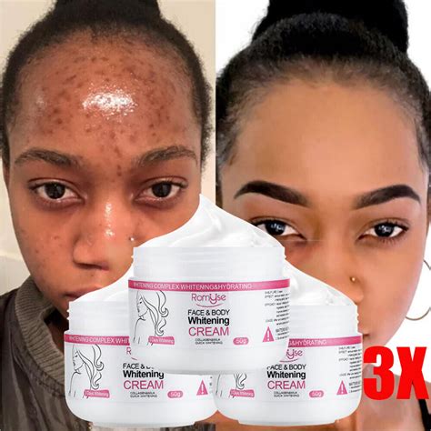 Why Skin Whitening Creams for Dark Skin May Not Be Worth the Risk