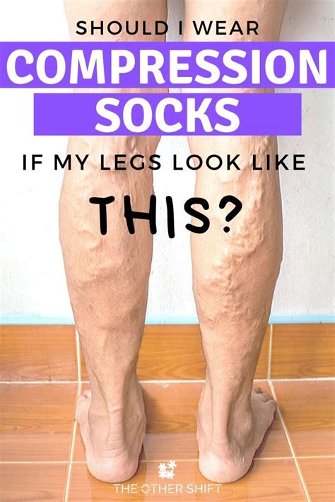 Why Wearing Compression Socks at Night May Not Be the Best Idea